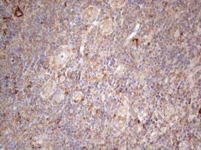 Immunohistochemistry: Jagged 1 Antibody (OTI3A10) [NBP2-45467]