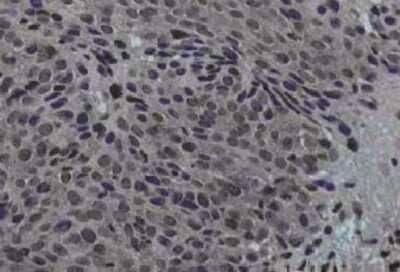 Immunohistochemistry: Jagged 1 Antibody [NB600-1161]