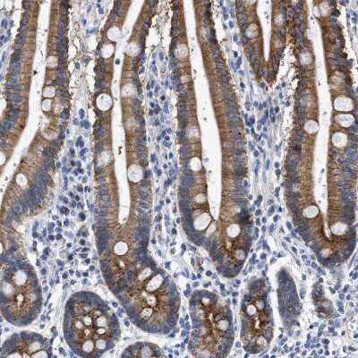Immunohistochemistry-Paraffin: Jagged 1 Antibody [NBP1-90208]