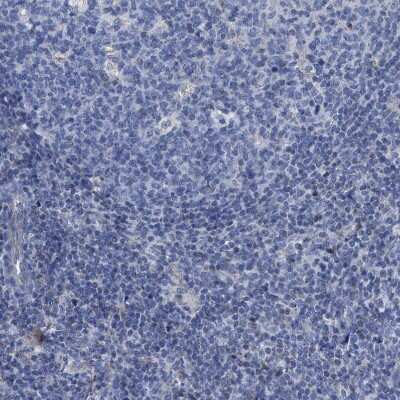Immunohistochemistry-Paraffin: Jagged 1 Antibody [NBP1-90208]