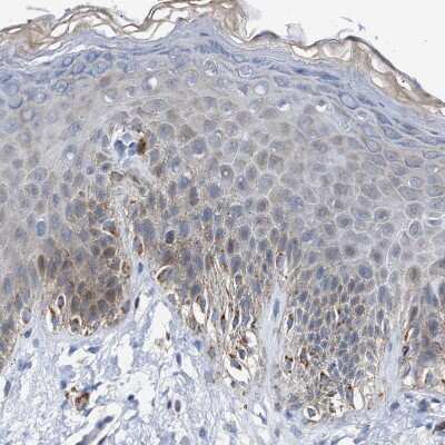 Immunohistochemistry-Paraffin: Jagged 1 Antibody [NBP1-90208]