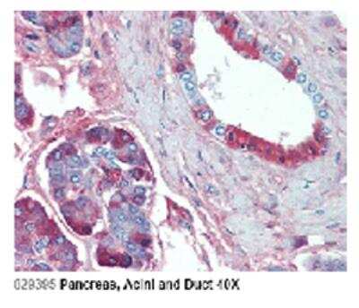 Immunohistochemistry: Jagged 1 Antibody (J1G53-3) - Azide and BSA Free [NBP3-11671]