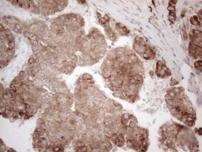 Immunohistochemistry: Jagged 1 Antibody (OTI3A10) - Azide and BSA Free [NBP2-70115]
