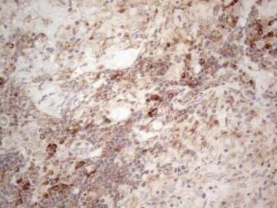 Immunohistochemistry: Jagged 1 Antibody (OTI3A10) - Azide and BSA Free [NBP2-70115]