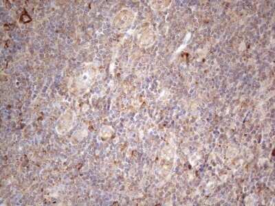 Immunohistochemistry: Jagged 1 Antibody (OTI3A10) - Azide and BSA Free [NBP2-70115]