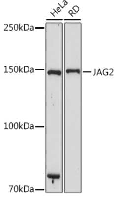 Western Blot: Jagged 2 Antibody (3K1I8) [NBP3-15726]