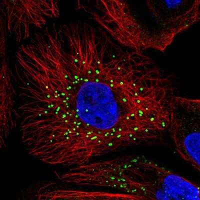 Immunocytochemistry/ Immunofluorescence: Jagged 2 Antibody [NBP2-55301]