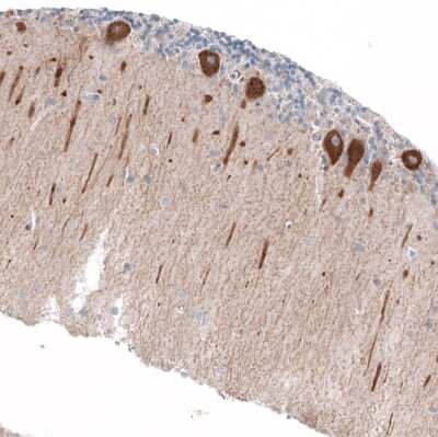 Immunohistochemistry-Paraffin: Jagged 2 Antibody [NBP1-86337]