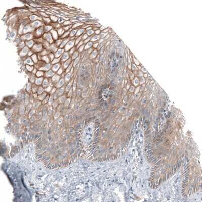 Immunohistochemistry-Paraffin: Jagged 2 Antibody [NBP1-86337]