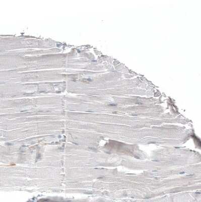 Immunohistochemistry-Paraffin: Jagged 2 Antibody [NBP1-86337]