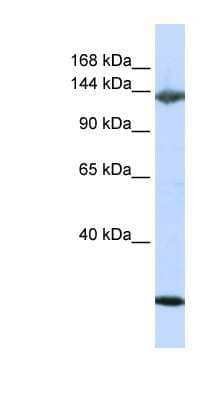 Western Blot: Jagged 2 Antibody [NBP1-58284]