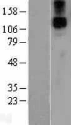 Western Blot: Jagged 1 Overexpression Lysate [NBL1-12091]