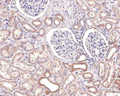 Immunohistochemistry-Paraffin: Jak1 Antibody (JM75-03) [NBP2-75547]