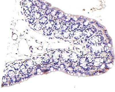 Immunohistochemistry-Paraffin: Jak1 Antibody (JM75-03) [NBP2-75547]