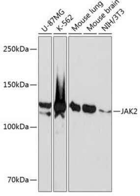 Western Blot: Jak2 Antibody (4B0K1) [NBP3-15825]