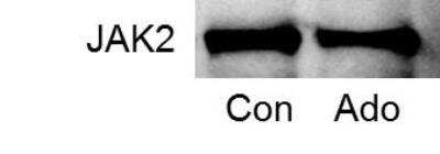 Western Blot: Jak2 Antibody (53B7)BSA Free [NBP2-59451]