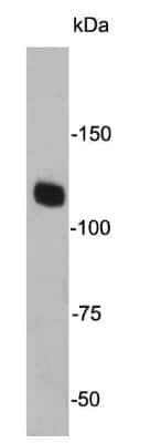 Western Blot: Jak2 Antibody (6-D3) [NBP2-66913]