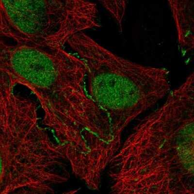 Immunocytochemistry/ Immunofluorescence: Jak2 Antibody [NBP2-55362]