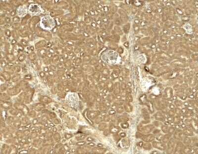 Immunohistochemistry: Jak2 Antibody - BSA Free [NBP2-41310]