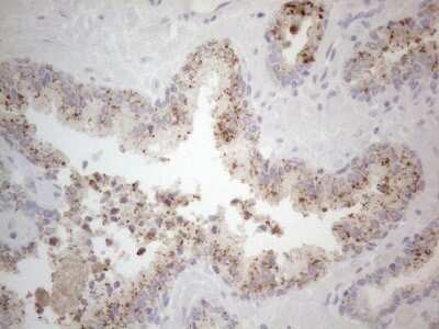 Immunohistochemistry: Jak2 Antibody (OTI7D12) - Azide and BSA Free [NBP2-71056]