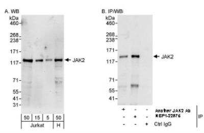 Western Blot: Jak2 Antibody [NBP1-22975]