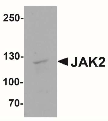 Western Blot: Jak2 AntibodyBSA Free [NBP2-41310]