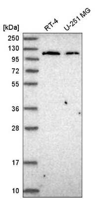 Western Blot: Jak2 Antibody [NBP2-55362]