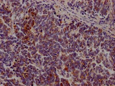 Immunohistochemistry: Jak3 Antibody (1C7) [NBP3-15196]