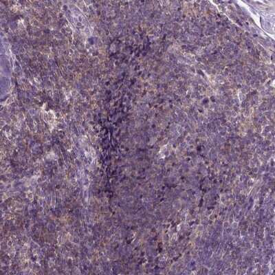 Immunohistochemistry-Paraffin: Jak3 Antibody [NBP2-49629]