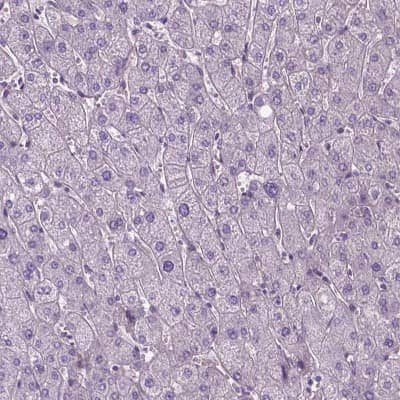 Immunohistochemistry-Paraffin: Jak3 Antibody [NBP2-49629]