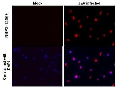 Immunohistochemistry-Paraffin: Japanese Encephalitis virus NS1 Antibody (GT1410) [NBP3-13569]