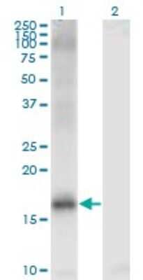 Western Blot: Jarid1A Antibody (1H2) [H00005927-M03]