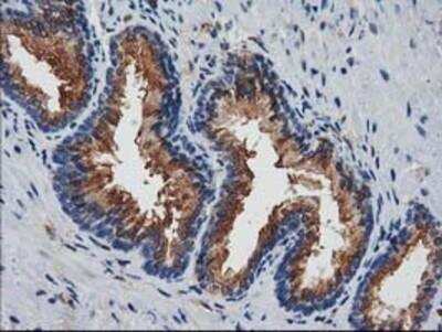 Immunohistochemistry-Paraffin: Josephin1 Antibody (OTI3B11) [NBP2-03442]
