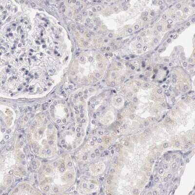 Immunohistochemistry-Paraffin: Josephin1 Antibody [NBP1-87864]