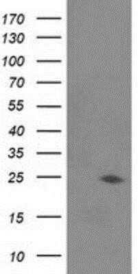 Western Blot: Josephin1 Antibody (OTI3B11)Azide and BSA Free [NBP2-71506]