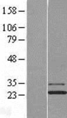 Western Blot: Josephin1 Overexpression Lysate [NBL1-12108]