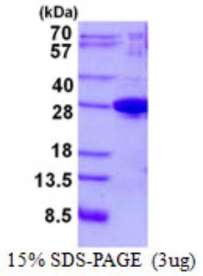 SDS-PAGE: Recombinant Human Josephin1 His Protein [NBP2-23156]