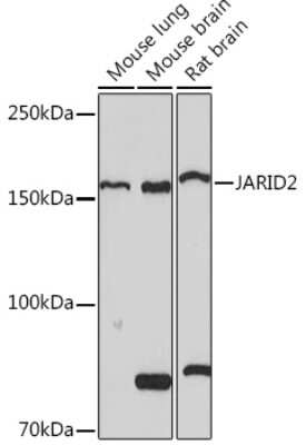 Western Blot: Jumonji/JARID2 Antibody (3L5C5) [NBP3-16839]