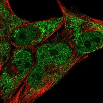 Immunocytochemistry/ Immunofluorescence: Jumonji/JARID2 Antibody [NBP2-57019]