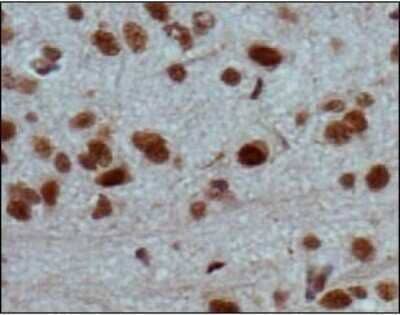 Immunohistochemistry-Paraffin: Jumonji/JARID2 Antibody [NB100-2214]