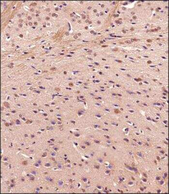 Immunohistochemistry-Paraffin: Jumonji/JARID2 Antibody - BSA Free [NBP3-00588]