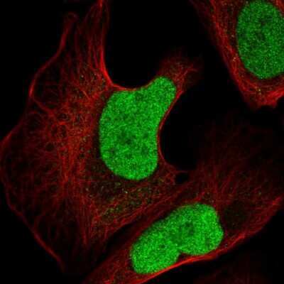 Immunocytochemistry/ Immunofluorescence: c-jun Antibody [NBP2-56932]