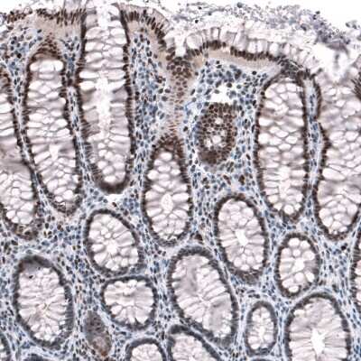 Immunohistochemistry-Paraffin: JunB/AP-1 Antibody [NBP1-89544]