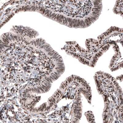 Immunohistochemistry-Paraffin: JunB/AP-1 Antibody [NBP1-89544]