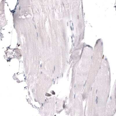 Immunohistochemistry-Paraffin: JunB/AP-1 Antibody [NBP1-89544]