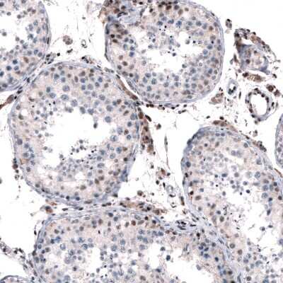 Immunohistochemistry-Paraffin: JunB/AP-1 Antibody [NBP1-89544]
