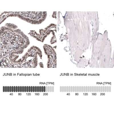 Immunohistochemistry-Paraffin: JunB/AP-1 Antibody [NBP1-89544]