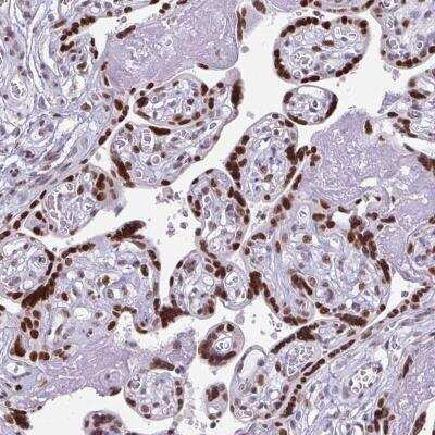 Immunohistochemistry-Paraffin: JunD Antibody [NBP2-38983]