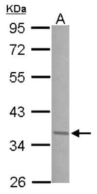 Western Blot: JunD Antibody [NBP2-17010]