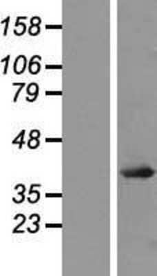 Western Blot: JunD Overexpression Lysate [NBP2-07760]